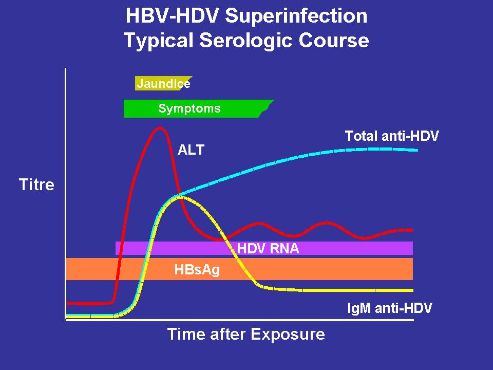 HBV-HDV Superinfection HDV infection of chronic HBV carriers Causes acute hepatitis with short incubation time High risk of severe chronic liver disease with cirrhosis (70 80%) HDV viremia