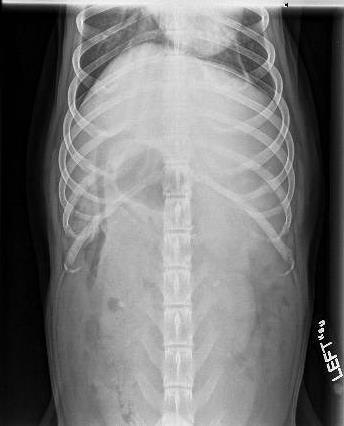 3 View Abdominal Radiograph Findings: Extrathoracic soft tissue is normal. Musculoskeletal structures are normal. The abdominal contour is normal.