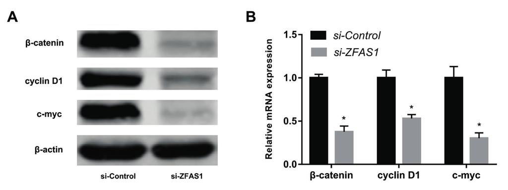 The role of ZFAS1 in nasopharyngeal carcinoma Figure 2. Low expression of ZFAS1 inhibits cell proliferation. A, After transfection of si-zfas1, ZFAS1 expression decreased significantly.