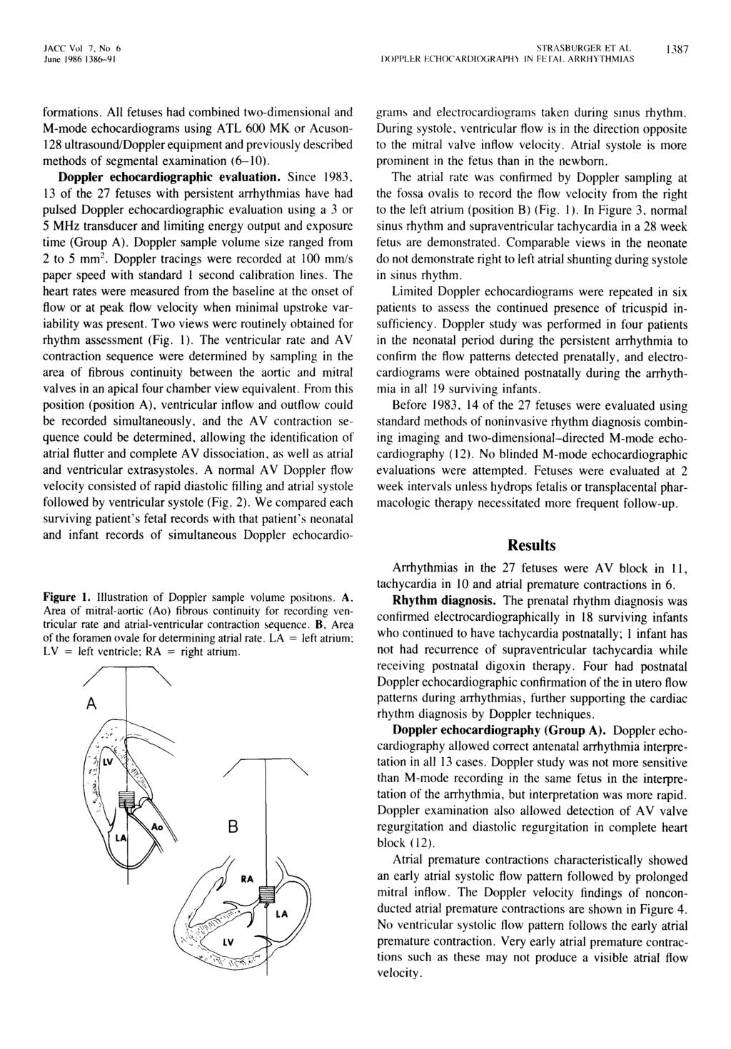 JACC Vol 7, No 6 June 1986 1386-91 STRASBURGER ET AL DOPPLER ECHOCARDIOGRAPH) IN FErAl. ARRHYTHMIAS 13S7 formations.