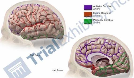 Posterior Cerebral Artery Supplies: Anterior and inferior parts of temporal lobe,