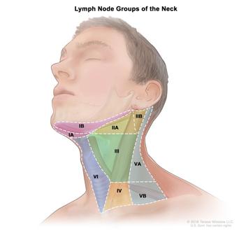 REGIONAL LYMPH NODES Internal jugular Jugulodigastric (II) Jugulo omohyoid (IV) Upper deep cervical II) Lower deep cervical (IV) Anterior cervical Prelaryngeal (VI)