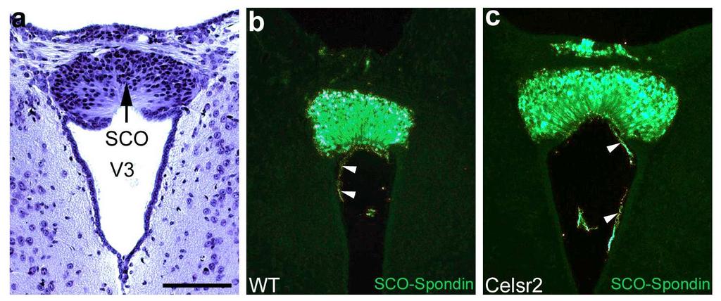 Supplementary Fig. 2: The subcommissural organ (SCO) develops normally in Celsr2 mutant mice. (a) Nissl stained coronal section at the level of the SCO at P10.