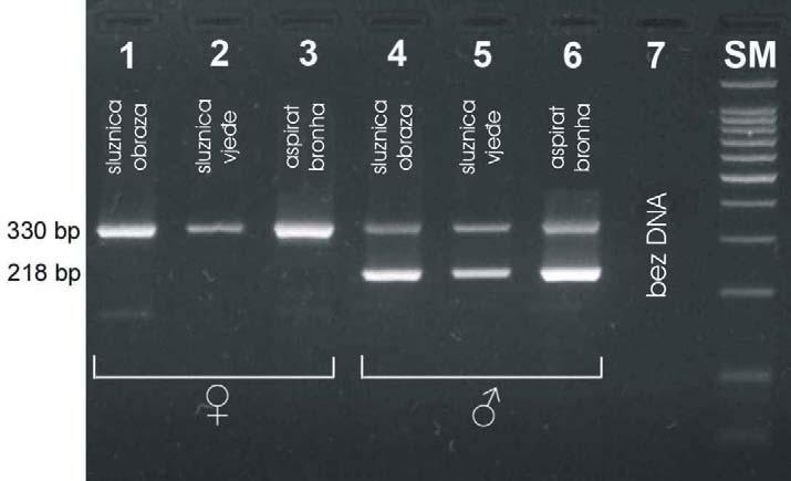 Kako bismo dokazali da je dobivena DNA prikladna za sigurnu i pouzdanu genotipizaciju pomoću PCR-a iz sva tri uzorka (aspirata bronha, brisa bukalne i vjeđne sluznice) izoliranu DNA iskoristili smo