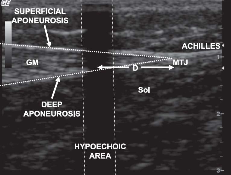 ultrasonography and motion