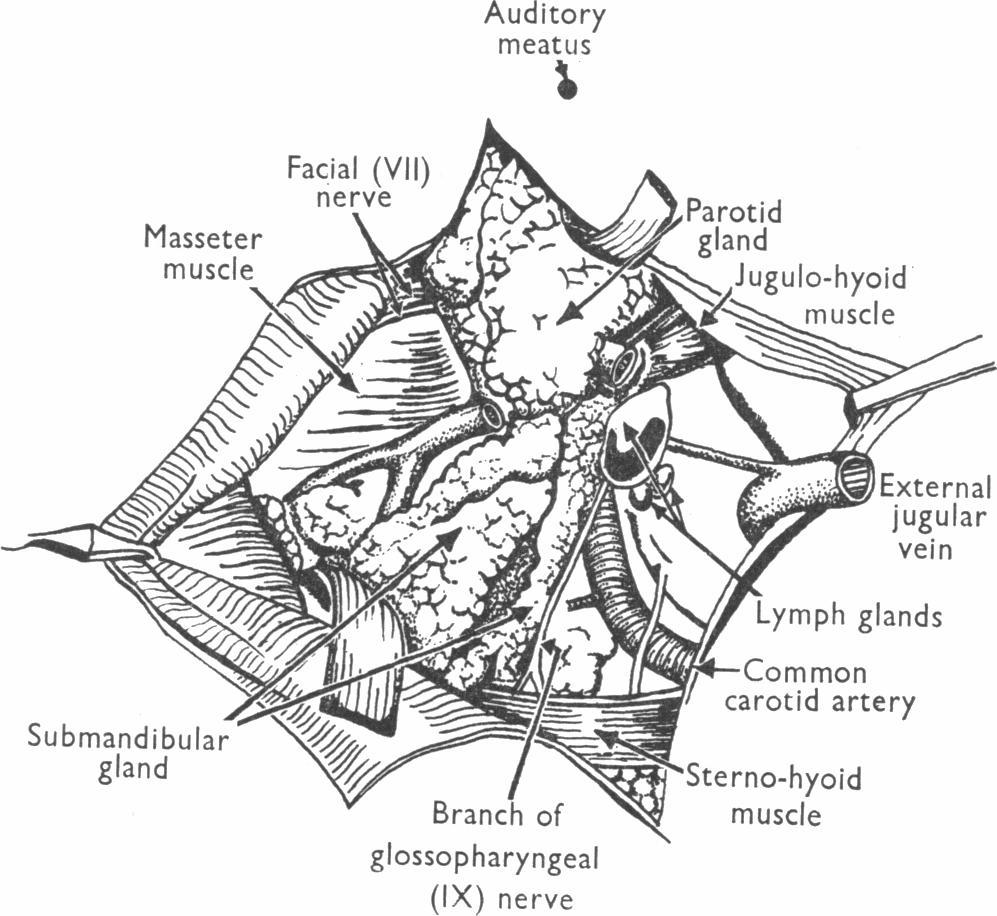 Auditory meatus glossopharyngeal (IX) nerve Fig. 4.
