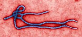 2. Ebola virus (EBV) Viral disease (Filoviridae family). Transmitted from wild animals to humans, direct human-to-human contact (blood, broken skin, mucous membranes, organs, bodily fluids).