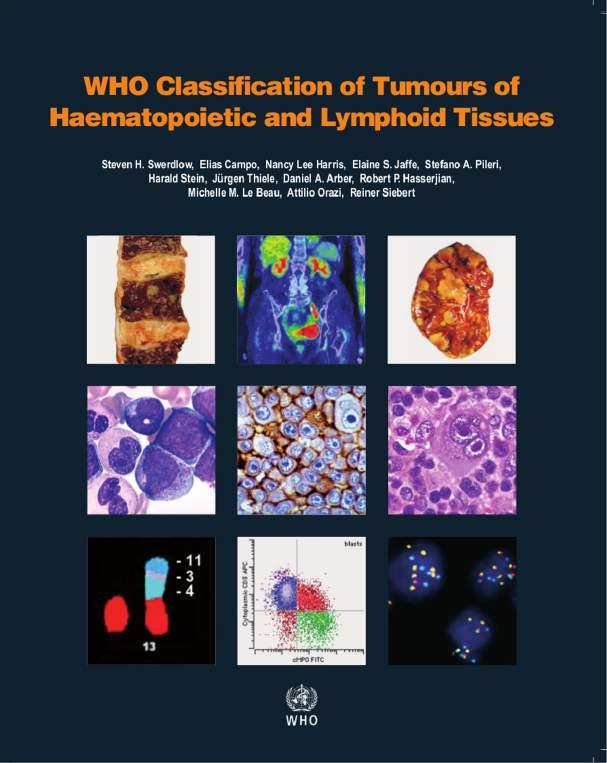 WHO Classification of Tumours of Haematopoietic and Lymphoid Tissues, 2017 70s 80s: Kiel classification B vs T cells: IHC!
