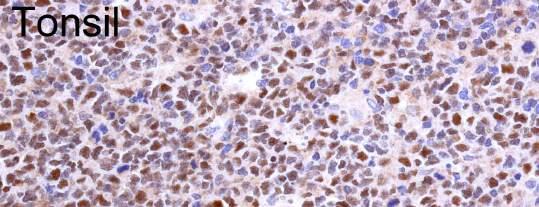 Basic stain: Bcl-6 Nuclear protooncogene product Normal: