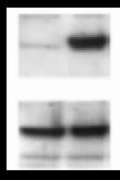 Conserved domains in JAK family members Cytokine Receptor Binding Pseudo kinase domain -autoinhibition of kinase -STAT Binding JH7 JH6 JH5 JH4 JH3 JH2 JH1 IP JAK2 WB: p-tyr WT V617F V617F Kinase