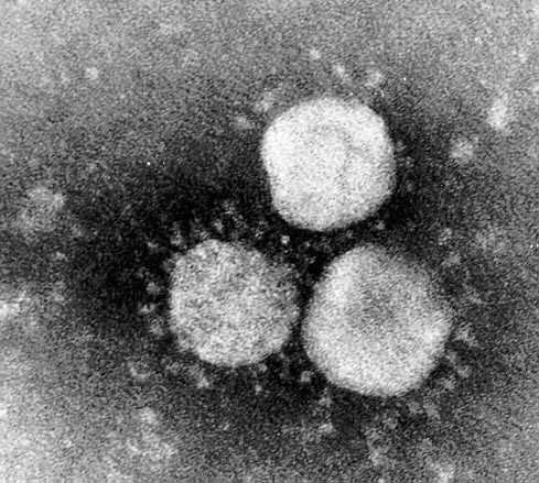 Structure Coronavirus virions are spherical to pleomorphic enveloped particles (Fig. 60-3).