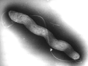 XV Rod Campylobacter (družina Campylobacteraceae) uvrščamo med nesporogene, po Gramu negativne patogene bakterije. Po obliki so spiralno ukrivljene.