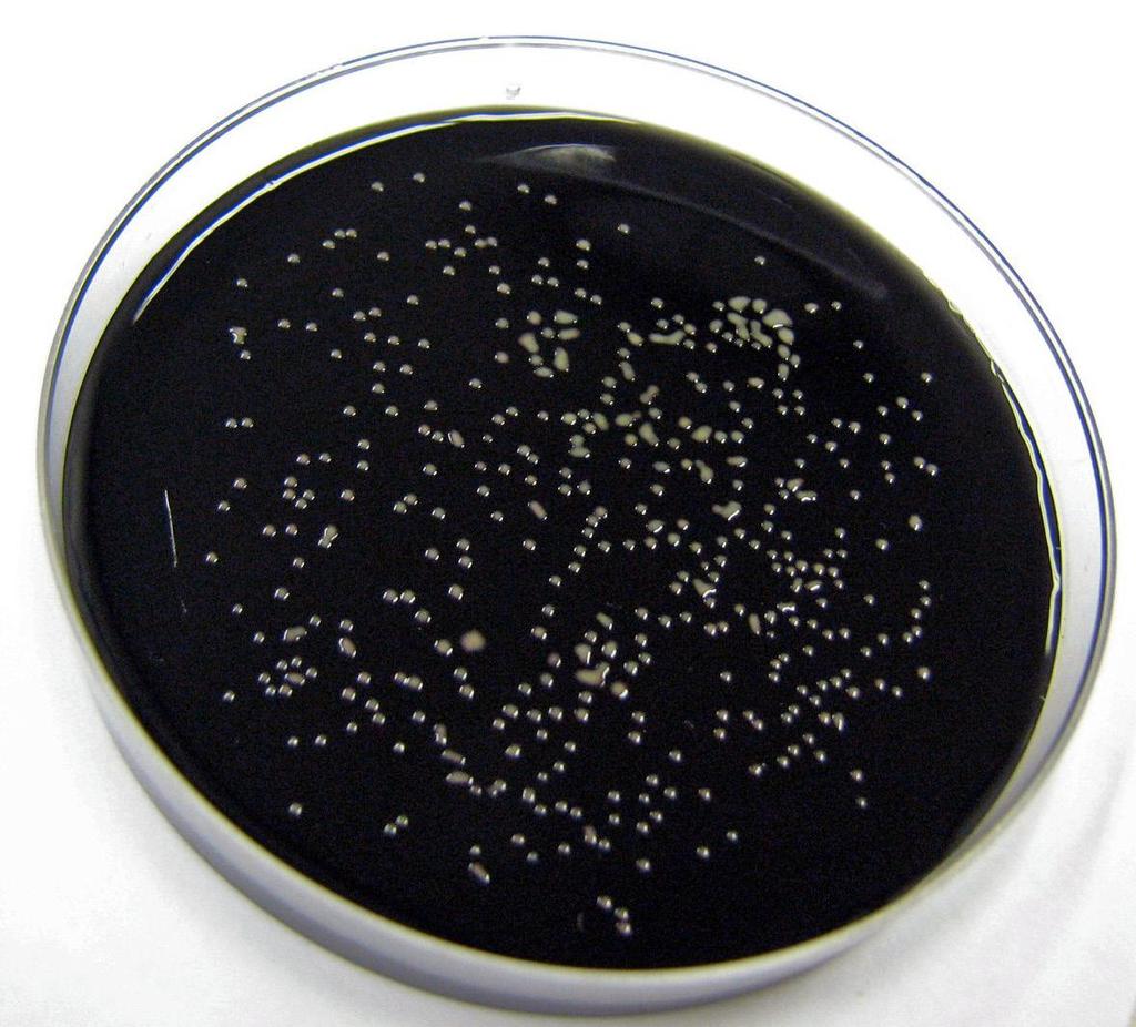 XXXVIII v mikroaerofilnih pogojih (3 % O 2, 10 % CO 2, 87 % N 2 ) za 48 ur pri 42 ºC, oziroma do pojava tipičnih kolonij.