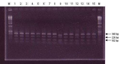 Restrikcijske analize 714 bp velikega pomnožka je z encimom BsmAI omogočila detekcijo točkovne mutacije (slika 41 in 42).