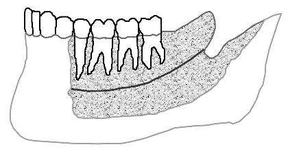 168 S. Rueda et al. Mandibular canal trabecular core Cortical bone Trabecular core mandibular canal cortical bone Fig. 1.