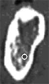 170 S. Rueda et al. a) b) c) d) e) Fig. 3. Semi-automatic landmarking steps Cortical bone Trabecular bone Mandibular canal Nerve Fig. 4.