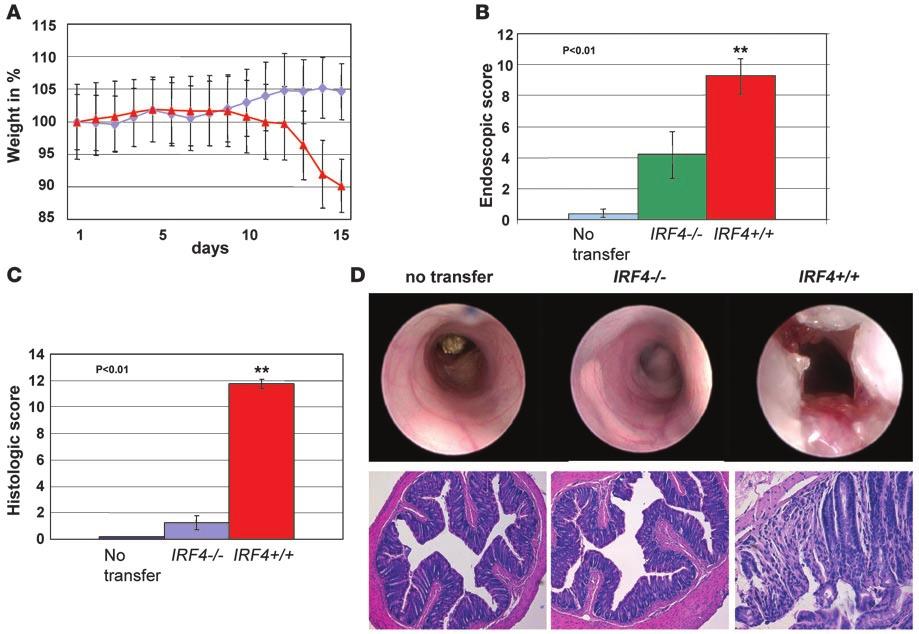 Figure 8 The protective effects of IRF4 deficiency are mediated via T lymphocytes: studies in the CD45RB hi adoptive transfer model of colitis.