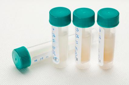 Advanced Hormone Testing I work with a CLIA-certified testing facility that uses cuttingedge technology to evaluate your saliva and blood spot samples.