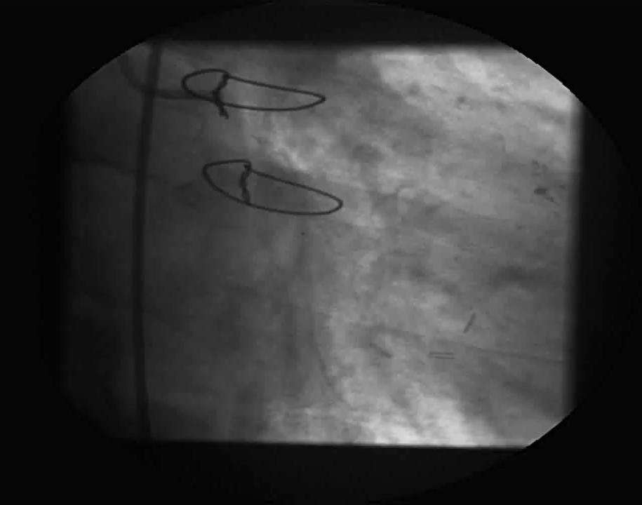 Case 2: CMR for