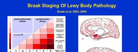 J Nucl Med 2008; 49:390 398 J Nucl Med 2009; 50:1638 1645; Neurology 83 August 26, 2014 Lewy body dementia