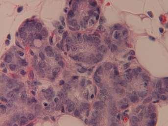 Hollow alveoli present in control mammary gland demonstrate the ability of the gland to