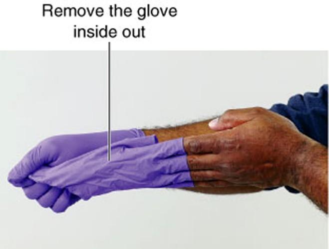 Skill: Removing Contaminated Gloves continued 2.