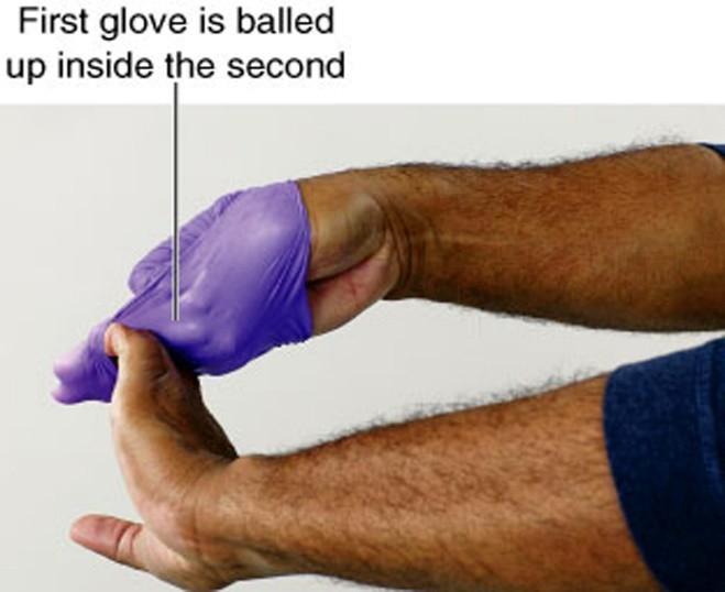 Skill: Removing Contaminated Gloves continued 4.