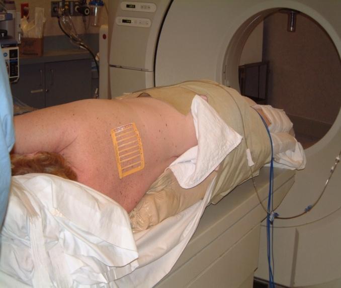 Fluoroscopy Series of 3 images/sec acquired to confirm device positioning All require