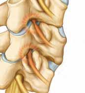 Nerve Root Problems Numbness, tingling, or weakness in your shoulders, arms, or hands may be the