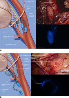 < Fluorescence Guided Surgery