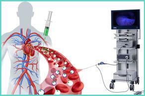 Intravenous injection of ICG