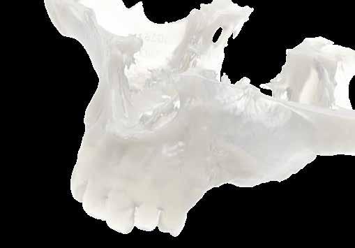 CUSTOM-MADE MODELS 3D-MODEL From a CT or CBCT scan, 3D-model service provides the segmentation and production of patient bone model. Models are patient reproductions in plastic material.