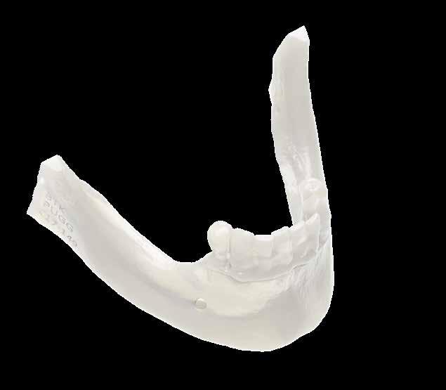 DIGITAL 3D PRINTING WITH 3D-PRINTER Thanks to the fully digital workflow, BTK can obtain models from the CT/CBCT exam.