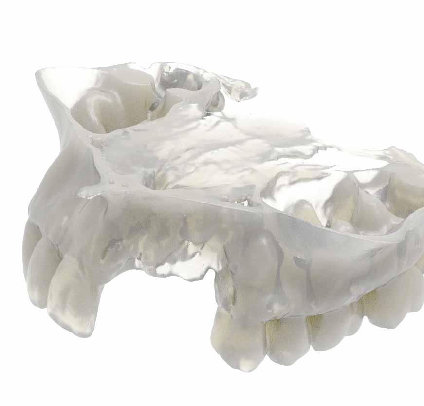 CUSTOM-MADE MODELS Segmentation and production service of bone models with highest 3D printing resolution 100% DIGITAL, 100% CUSTOMIZED.