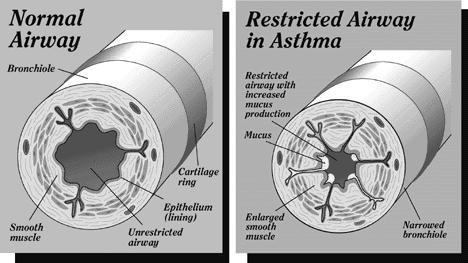 bronchodilation - vasoconstriction Asthma