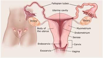 Advanced Endometrial Treatment Stage III: Regional Stage IV: Distant Stage IIIA Endometrial Cancer Stage IIIB Endometrial Cancer Stage IIIC Endometrial Cancer Stage IVA Endometrial Cancer Stage IVB