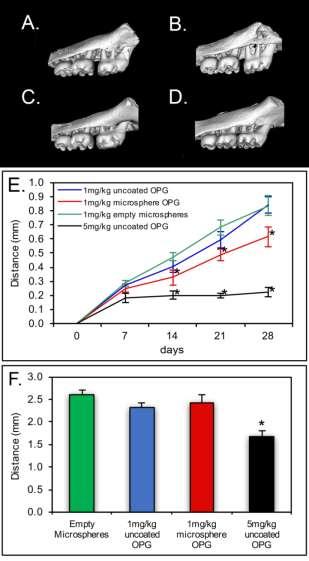 encapsulated inhibits molar but not incisor tooth movement. (A-D) Micro CT isosurface images of representative samples immediately post tooth movement are shown.