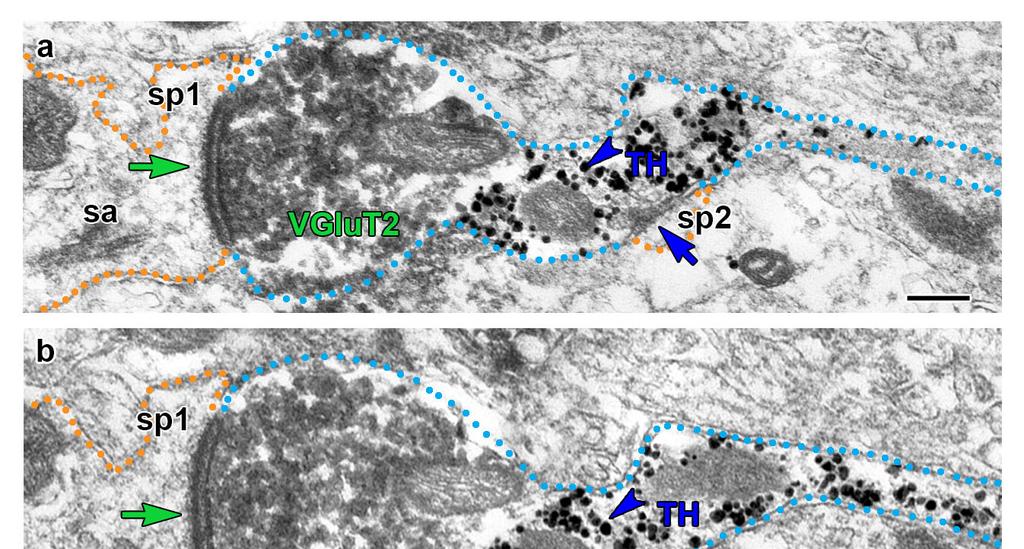Supplementary Figure 1 Subcellular segregation of VGluT2-IR and TH-IR within the same VGluT2-TH axon (wild type rats).