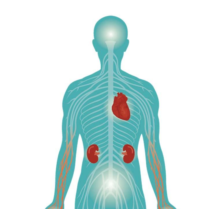 Amyloid Deposits Buildup in Multiple Organs and Cause Organ Failure 1 HEART
