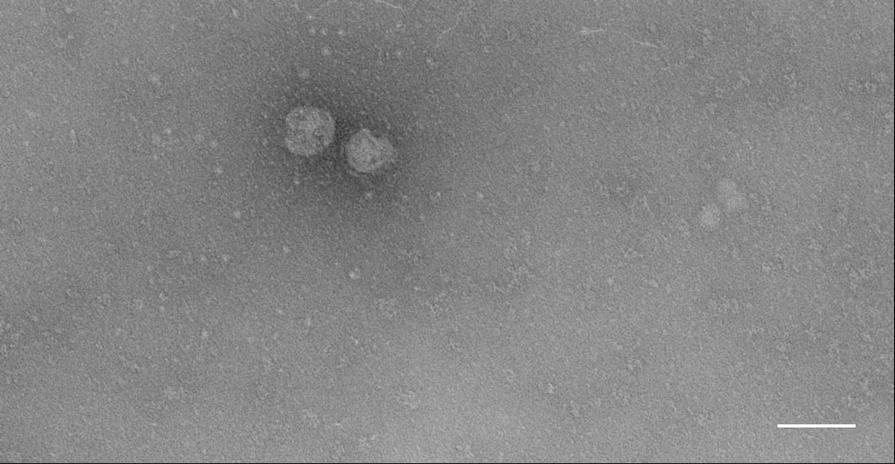 Electron microscopy image of exosomes Electron microscopy of exosomes from human