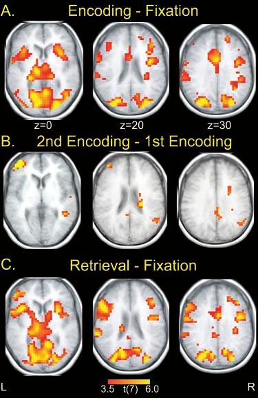 4of5 J. Neurosci., 2000, Vol. 20 Ranganath et al. Prefrontal Cortex and Episodic Remembering Figure 2. Activation during encoding and retrieval trials.