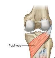 Popliteus O: Posterior surface of proximal tibia above soleal line I: Lateral femoral condyle A: Unlocks knee joint