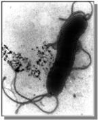 Helicobacter pylori A class 1 biological carcinogen (IARC, 1994) In antrum, associated with; somatostatin secretion gastrin (hypergastrinaemia) acid