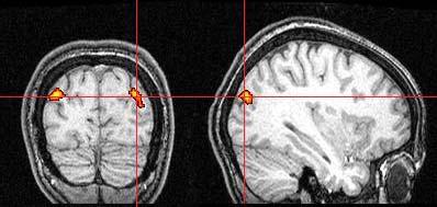 Parahippocampal Place Area (PPA) Retrosplenial Cortex (RSC)
