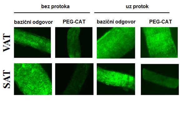 Slike 16A i 16B prikazuju proizvodnju H 2 O 2 u otporničkim žilama visceralnog i potkožnog masnog tkiva kod pretilih osoba koristeći metodu fluorescentne mikroskopije.