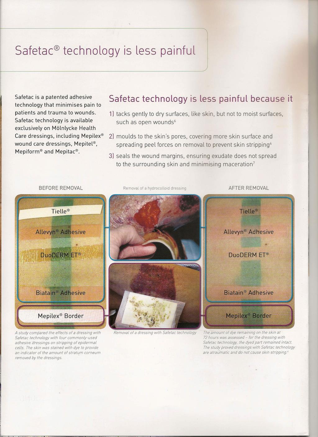 Safetac technology is less painful Safetac is a patented adhesive technology that minimises pain to patients and trauma to wounds.