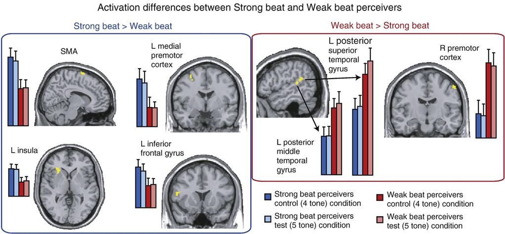 1900 J.A. Grahn, J.D. McAuley / NeuroImage 47 (2009) 1894 1903 Fig. 4. Areas in which activation differences between strong beat-perceivers and weak beat-perceivers are observed.