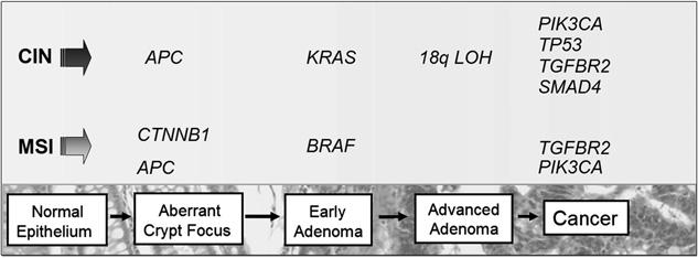 Figure 1 The adenomaecarcinoma progression sequence. Colorectal carcinogenesis progresses by at least two well-recognised pathways.