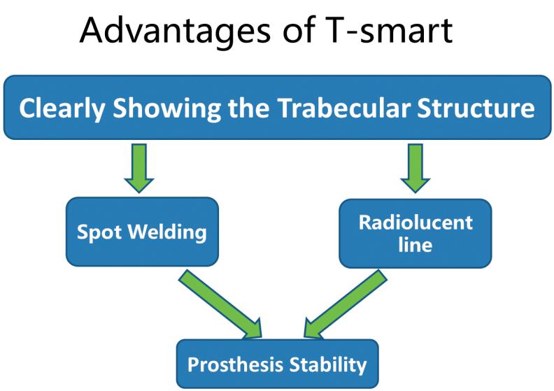 2. Content of the Presentation 2.1. T-smart Algorithm Shimadzu worked on the project named as T-smart.