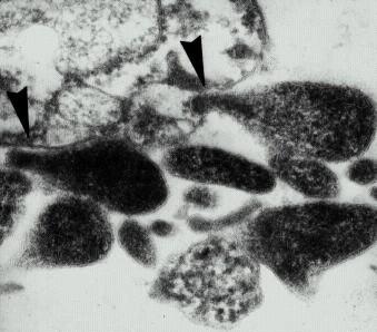 8 M. genitalium je ploščate oblike, je gibljiva (Seto in sod., 2001) in ima terminalno koničasto strukturo, ki jo uporablja za pritrditev na gostiteljske celice (Jensen, 2006). (Pritrditev M.